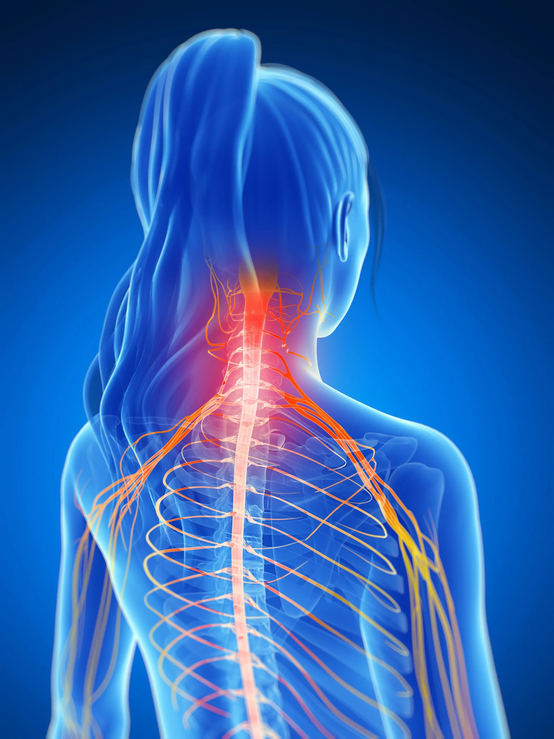 Using a Dermatome Chart to Better Understand Back and Neck Pain